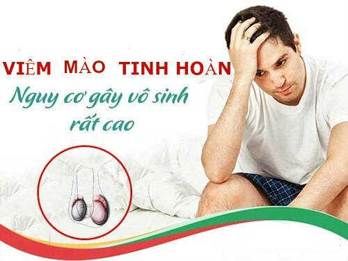 Viêm mào tinh hoàn gây vô sinh